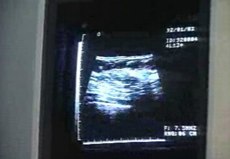 Novo medicamento para o Cancro