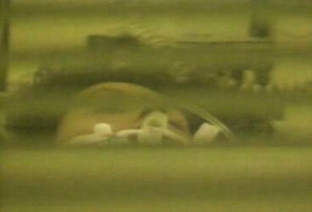 Mulher grávida sem intestino