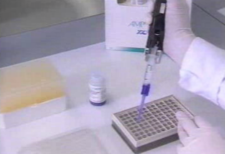 Diagonóstico da SIDA