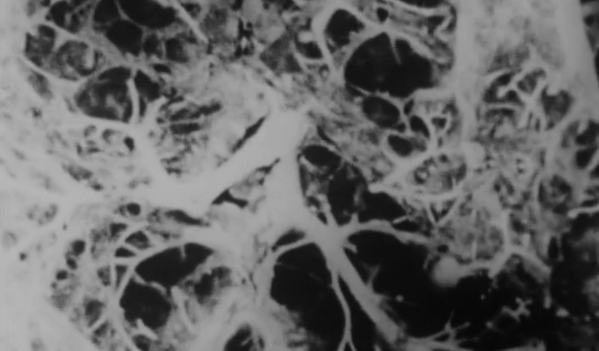 Os Efeitos do Tabaco