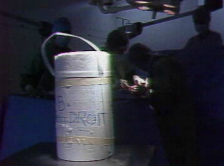 Falta de rins para transplantes