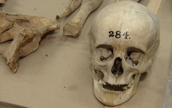 Como Funcionam os Testes de DNA