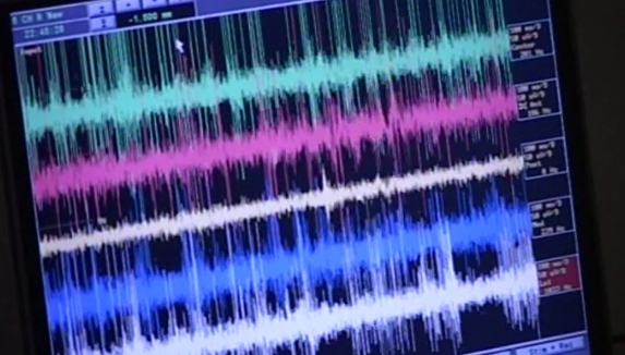 Tratamento da Doença de Parkinson