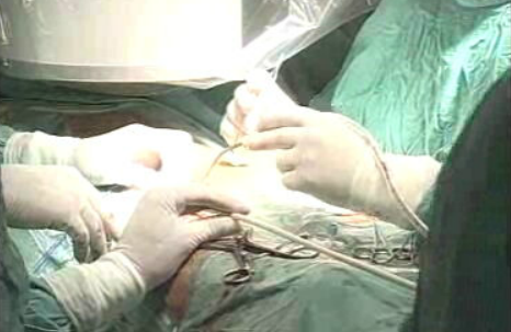 Cirurgia pioneira em Portugal