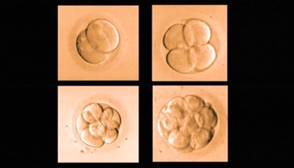 Reprodução Medicamente Assistida