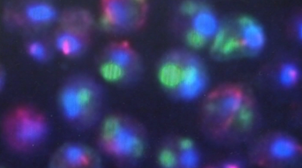 Envelhecimento e Doenças Degenerativas