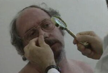 Campanha de rastreio do melanoma