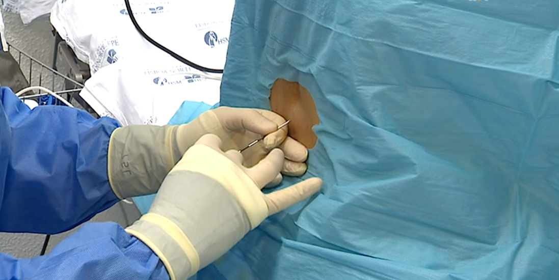 Falta de anestesistas