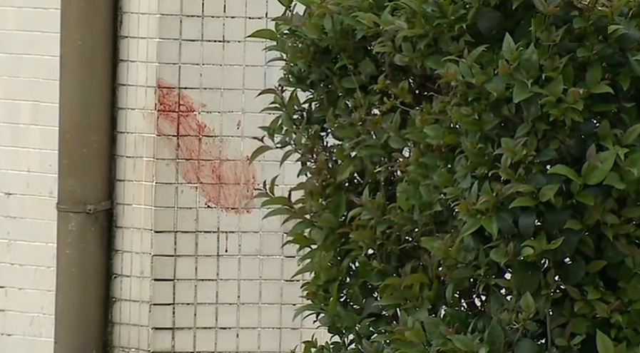 Ataque de cão em Matosinhos