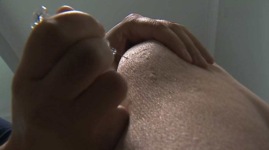 Hepatite A em Portugal