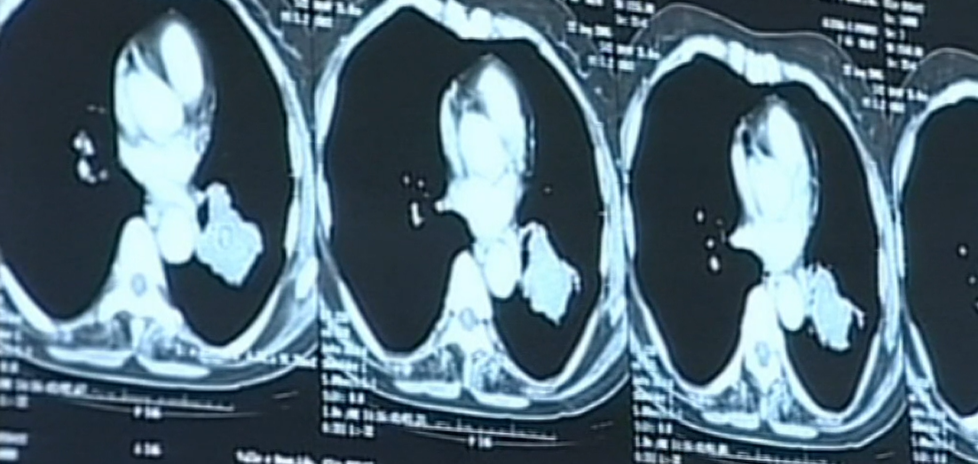 Demissões no Hospital de Gaia