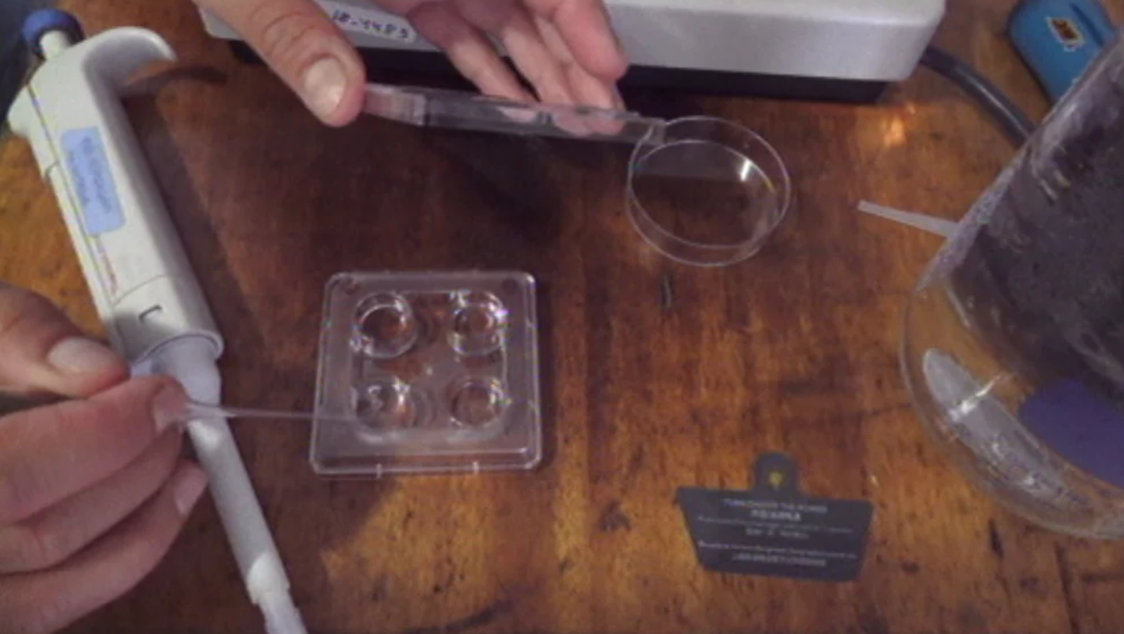 Pescado contaminado com ciguatoxinas