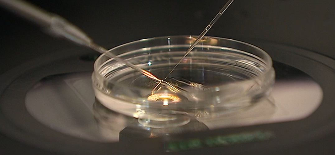 Tratamento de infertilidade