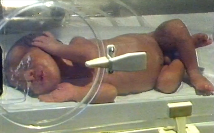 Transporte de prematuros