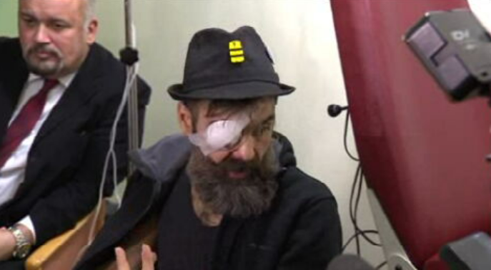 Luso francês ferido