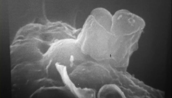 Umas células chamadas Macrófagos