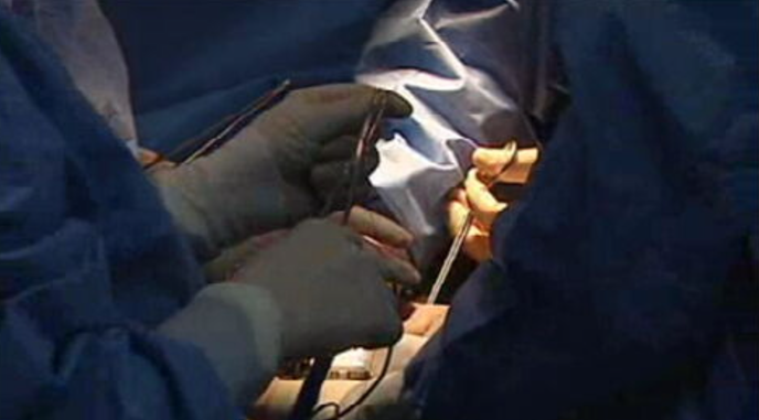 Doação e transplantes de órgãos em Portugal