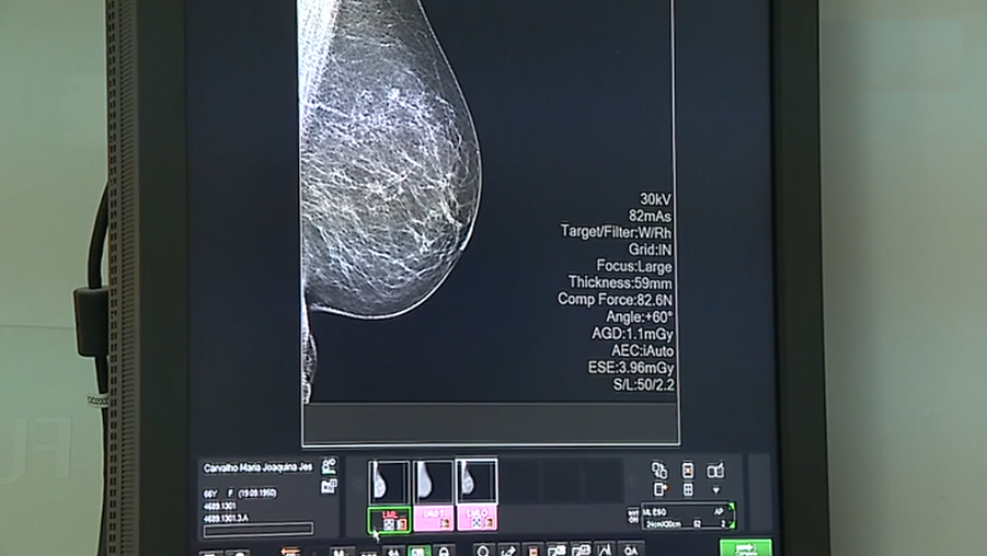 Dia de Prevenção do Cancro da Mama