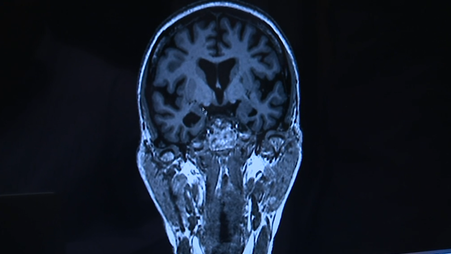 “NeuroPsyCAD” na Web Summit