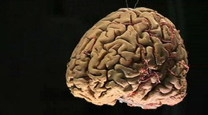 Exposição “Cérebro mais vasto que o céu”