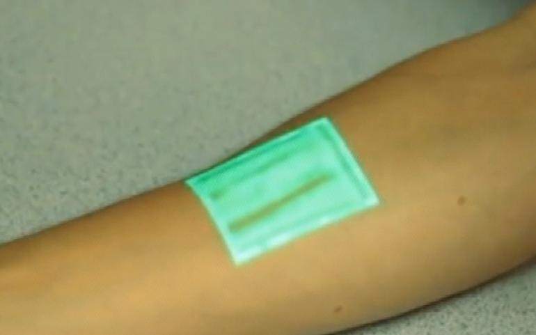 Doação de equipamento médico para detetar as veias através de infravermelhos