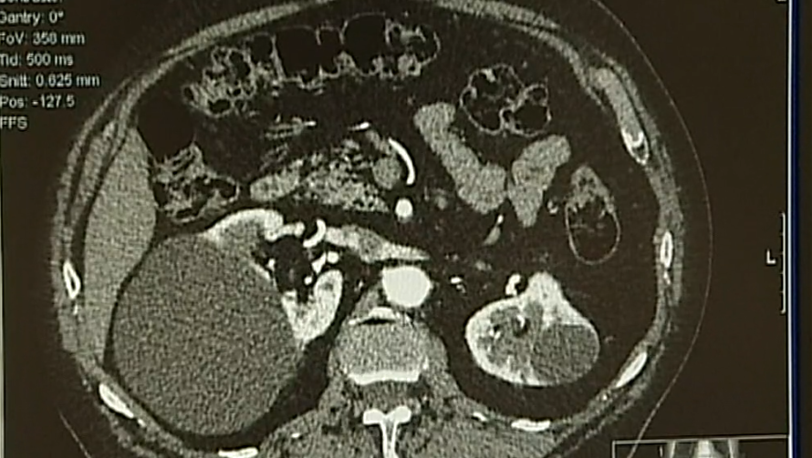 Mortes nas urgências hospitalares