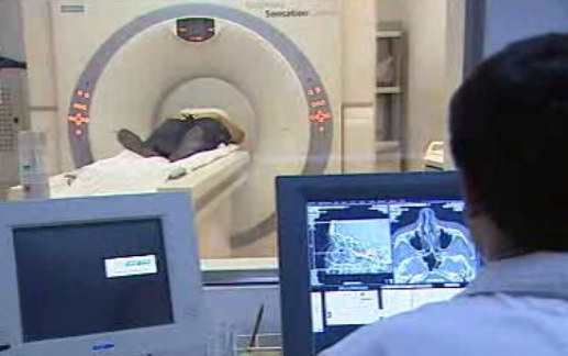 Modelo experimental de doença de Alzheimer