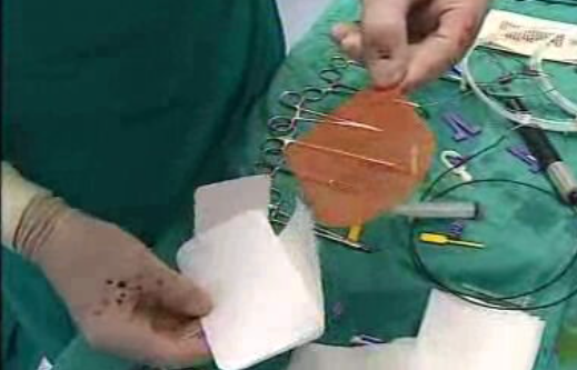 Combate a doenças provocadas por pacemaker