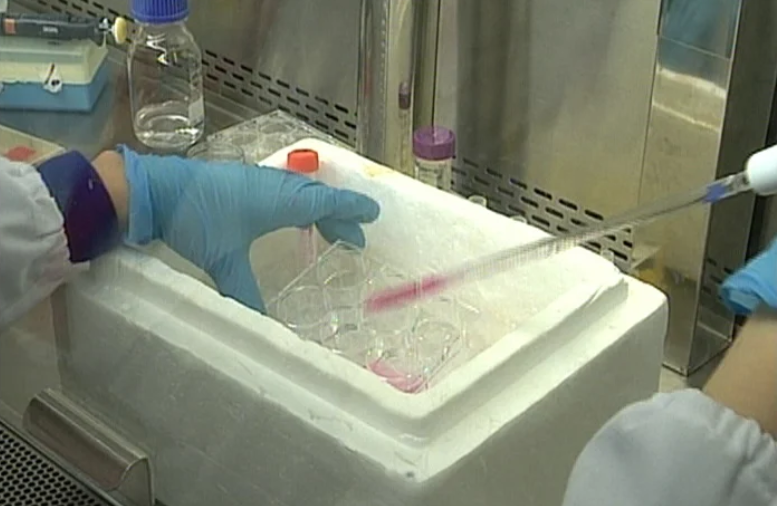 Nova terapia para tratar doentes com AVC