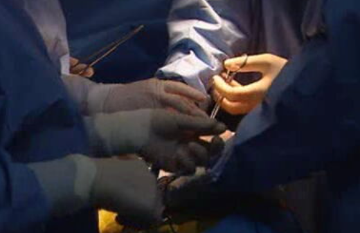 Transplante de rim de dador incompatível