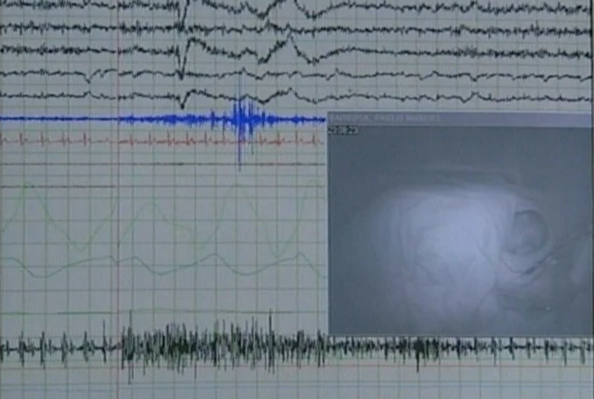 Comemoração do Dia Mundial do Sono