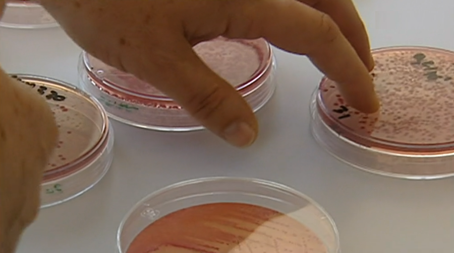 Doença do Legionário é contagiosa