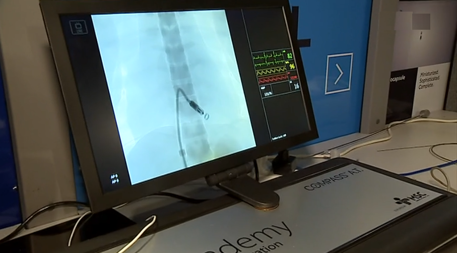 Autocarro “Millie” dá a conhecer inovações no tratamento cardíaco II