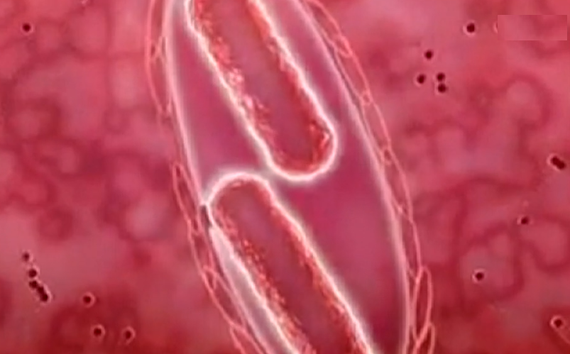 Doença do Legionário