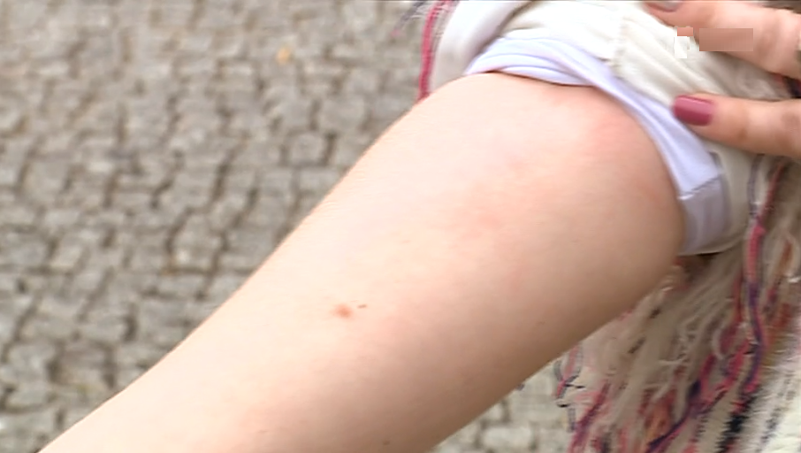 Casos de sarna em Peso da Régua