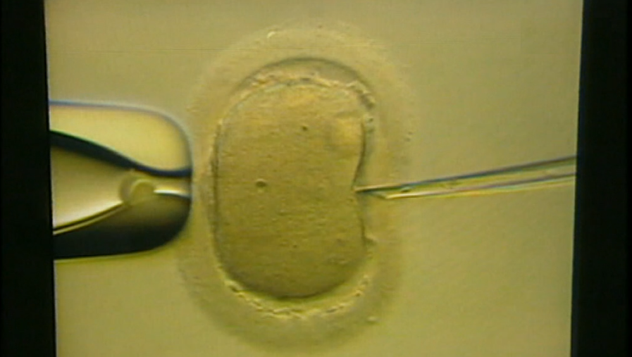 Tratamentos da infertilidade