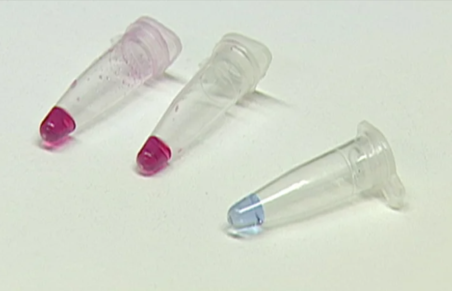 Falta da vacina da BCG