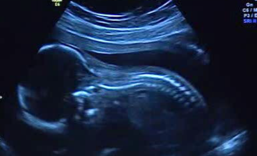 Governo incentiva natalidade