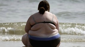 Imagem de Obesidade: Alerta nas praias!
