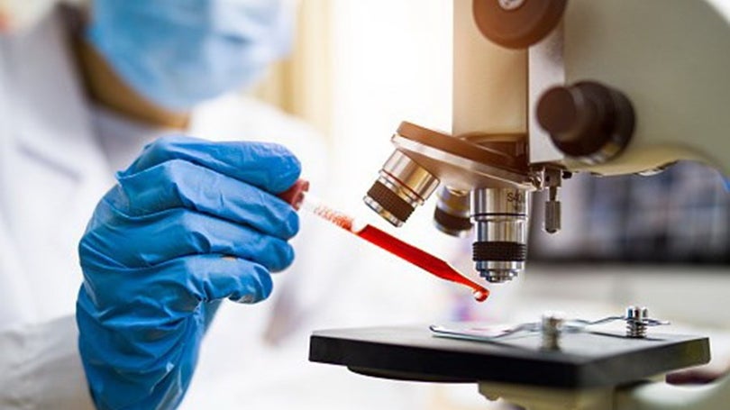 Imagem de Universidade de Évora desenvolve moléculas para tratar cancro