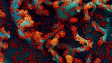 Imagem de Cientistas dizem que Ómicron é um alerta da ameaça do vírus