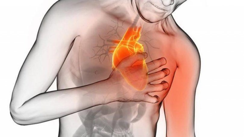 Imagem de Doenças cardiovasculares matam