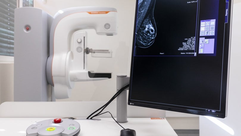 Imagem de Rastreio do Cancro da Mama chega sexta-feira a Machico