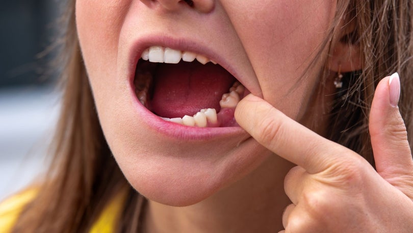 Seis milhões de pessoas têm falta de dentes em Portugal