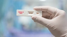 Imagem de Teste rápido substitui o teste PCR (áudio)