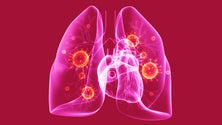 Imagem de Portugal é país europeu onde mais se morre de pneumonia