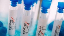 Imagem de Covid-19: Madeira sem novos casos e com mais um doente recuperado