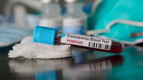 Imagem de Covid-19: Portugal com mais 6.087 casos