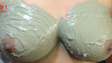 Tratamento com argila promete combater nódulos mamários