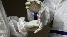 Imagem de Covid-19: Pandemia abalou sistemas de saúde de todo o mundo – OMS